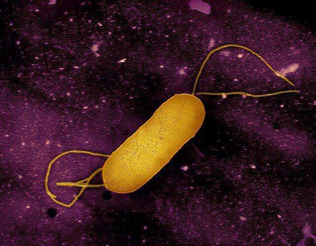 2024’s Listeria outbreak has L.I. food industry, consumers on high alert